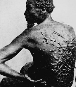 Whip scars of a slave